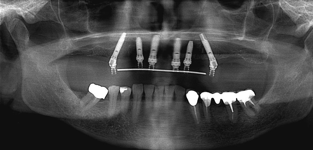 10. Prosthodontist